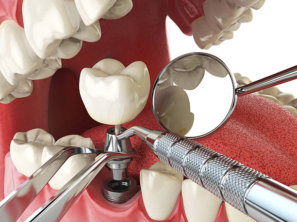 Best Emergency Denture Repair in Lake Odessa, MI